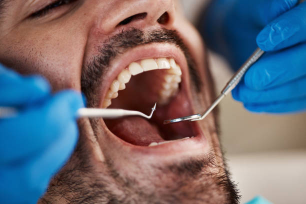 Best Mobile Emergency Dentist in Pine Manor, FL