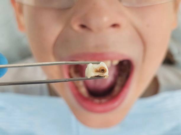Emergency Cosmetic Dentistry